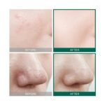 Some By Mi AHA. BHA. PHA 30 Days Miracle Toner 150mls